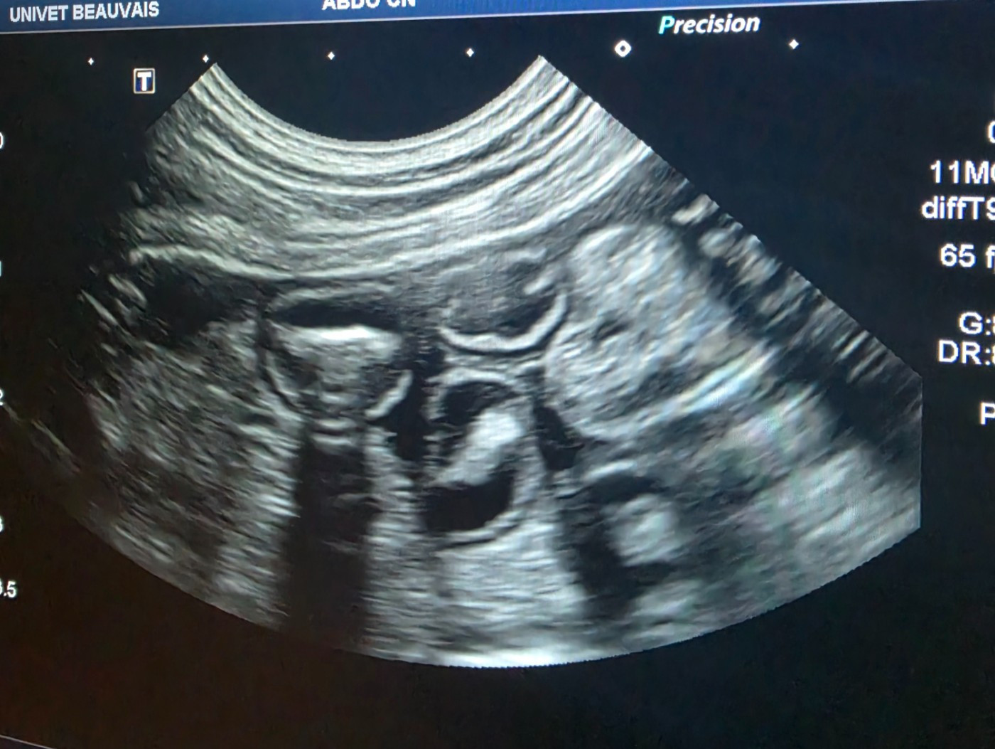 Arouch Memory's - ♡ GESTATION CONFIRMÉ ♡